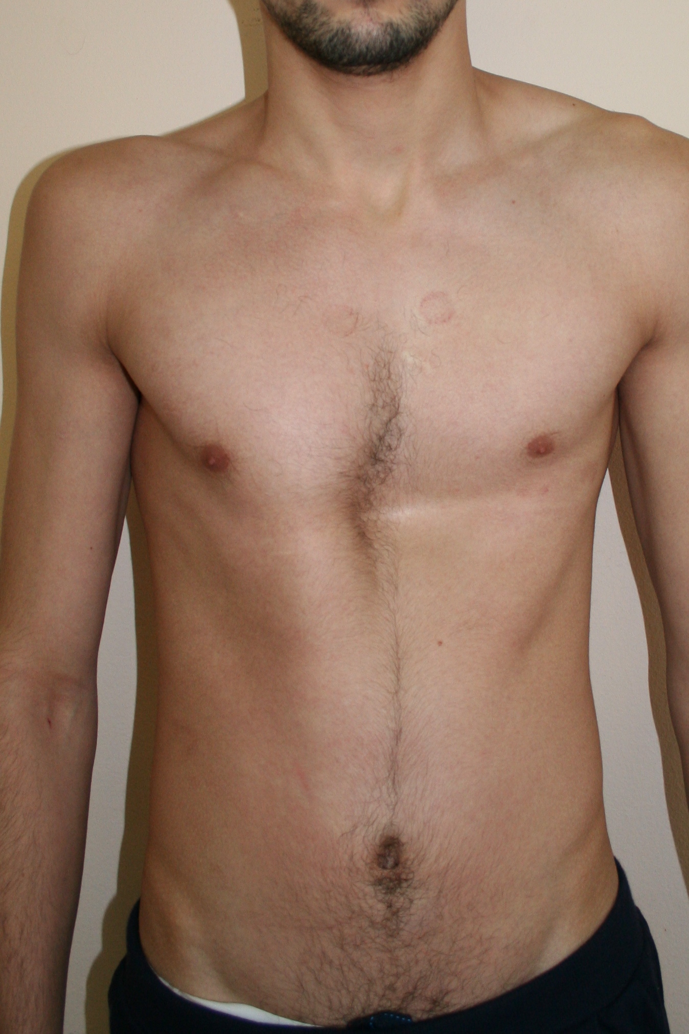 длинная грудь у мужчин фото 110
